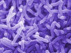 Haïti - Santé - ALERTE : Au moins 50 morts, épidémie de choléra ?