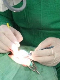 Haïti - FLASH : Grâce à Castro et Chávez, les cubains ont rendu la vision à plus de 72,000 haïtiens