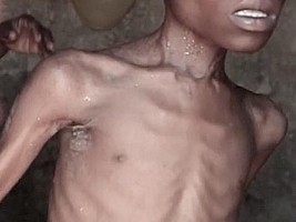 Haïti - Crise : Plus de 18% de la population à risque de malnutrition très élevée