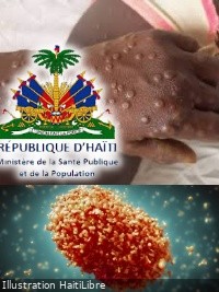 Haïti - FLASH : Message important du Ministère de la Santé