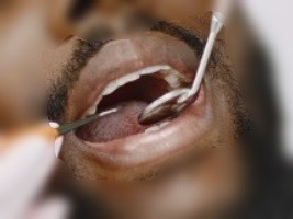 Haïti - Santé bucco-dentaire : le Ministère lance un appel à la mobilisation nationale